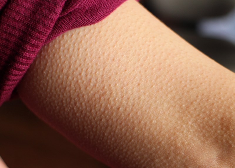 RE: What Gives You Goosebumps?8