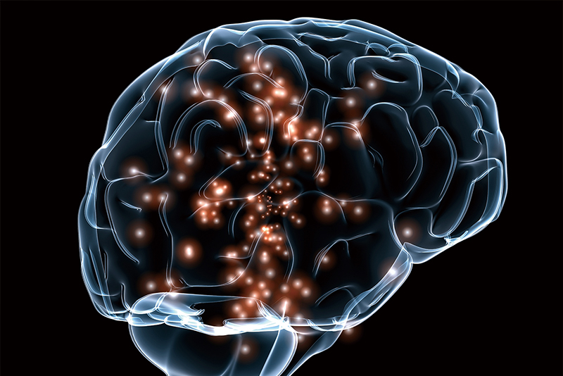 Neurotechnology: Reading Signals From the Brain0