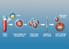 CAR-T Therapy: A Revolutionary Leap in Personalized Cancer Treatment - Science