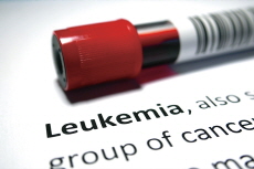 Understanding Blood Cancer - Science