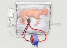 Development Of Artificial Wombs May Alter Human Society - Science