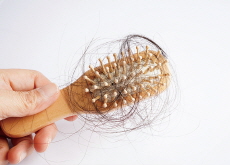 How To Prevent Hair Loss - Health