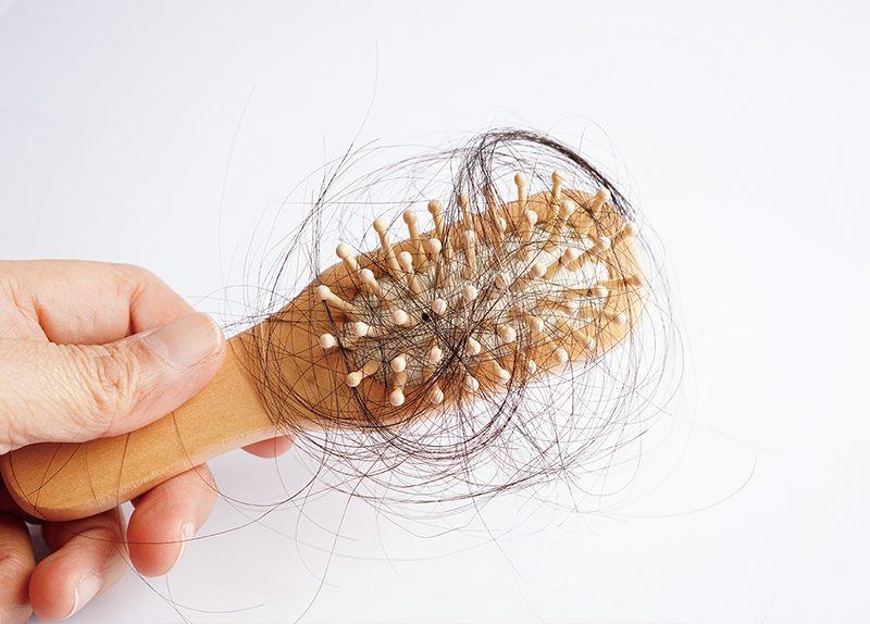 How To Prevent Hair Loss0