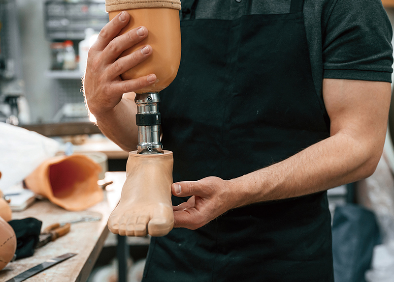 What Are Prostheses?0