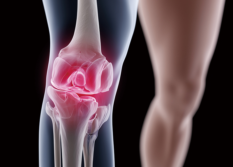 Be Kind to Your Knees6