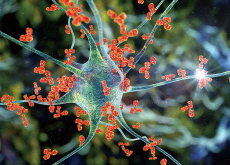 New Inverse Vaccine That May Wipe Out Autoimmune Diseases - Science