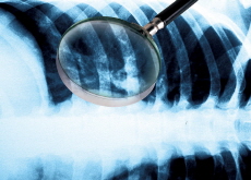 The Accidental Discovery of X-Rays - History
