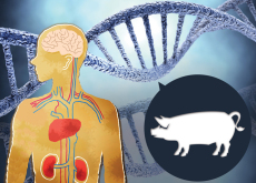 Pig-to-Human Transplants Research Advances - Headline News