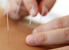 Does Acupuncture Work? - Debate