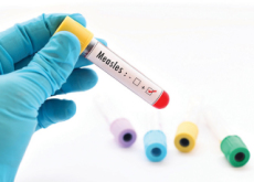 Rockland County’s Emergency Measures Over Measles Outbreak - Special Report